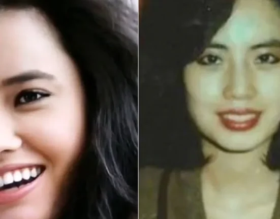 Modelul Hang Mioku și-a injectat ulei de gătit în față după operații estetice eșuate